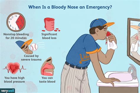 Practical Measures to Prevent Reoccurring Episodes of Bleeding in the Throat While Sleeping