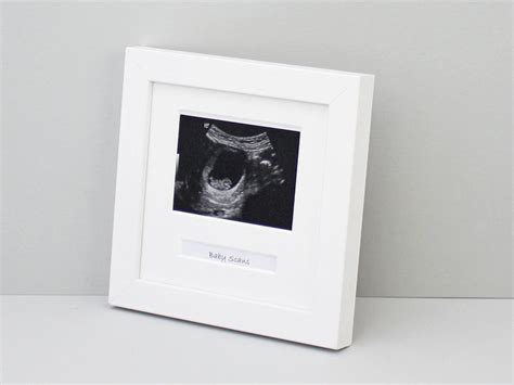 Precious Memories: Preserving the Blissful Moments of a Baby Scan with Souvenirs