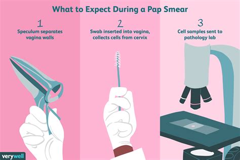 Preparing for a Pap Smear: Tips and Advice