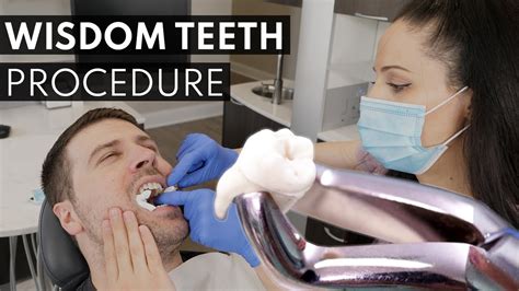 Preparing for the Extraction of Wisdom Teeth: What to Expect