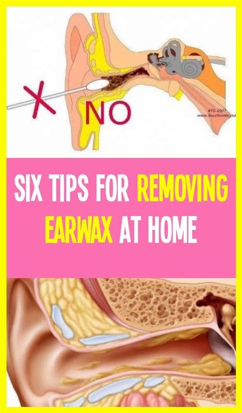 Preventing Accumulation of Earwax: Lifestyle Habits to Consider