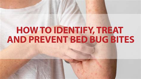 Preventing Bed Bug Bites