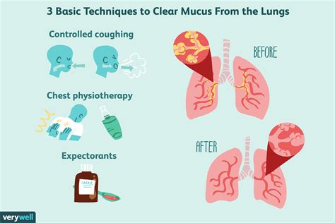 Preventive Measures to Maintain Healthy and Clear Mucus