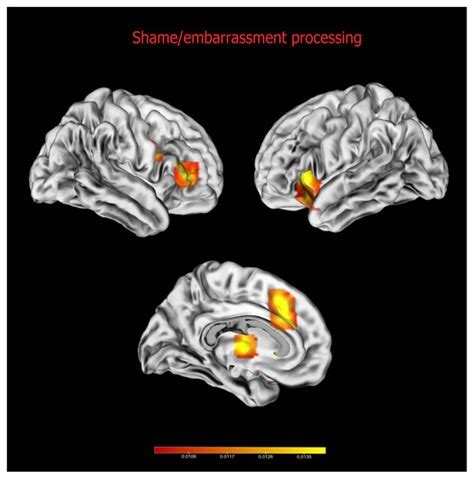 Psychological Analysis: Uncovered Toilets as a Representation of Shame and Embarrassment