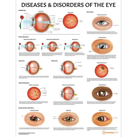 Psychological Disorders and the Enigma of Eyeball Loss Dreams: A Deeper Examination