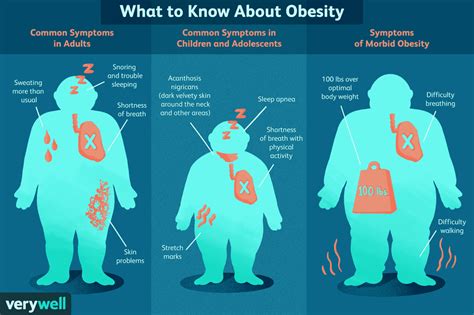 Psychological Interpretation: What Does the Overweight Gentleman Symbolize?