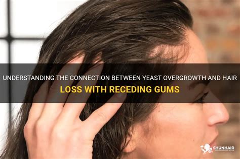 Reasons Behind Occurrence of Fungus Overgrowth in Hair