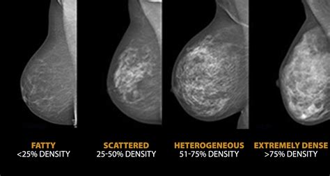 Reasons for the Development of Breast Abnormalities in Real Life