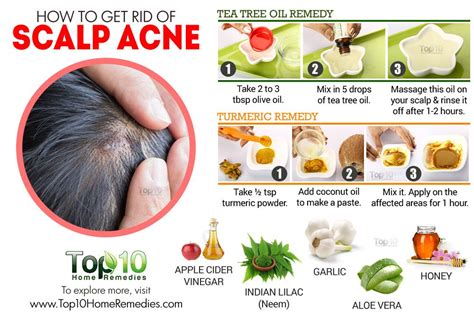 Remedies and Treatment for Sore Spots on the Scalp