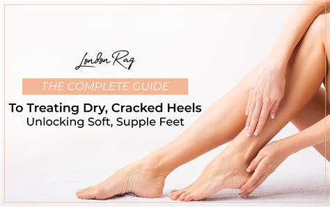 Say Goodbye to Cracked Feet: Expert Advice for Soft and Supple Skin