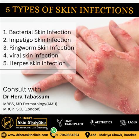 Skin Infections