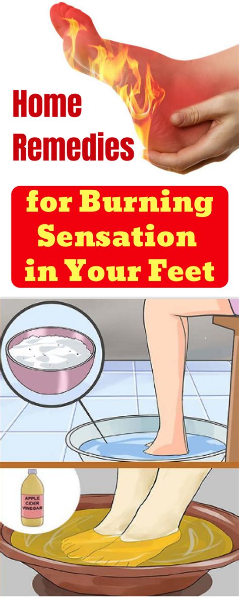 Strategies to Cope with Recurrent Sensations of Burning Feet