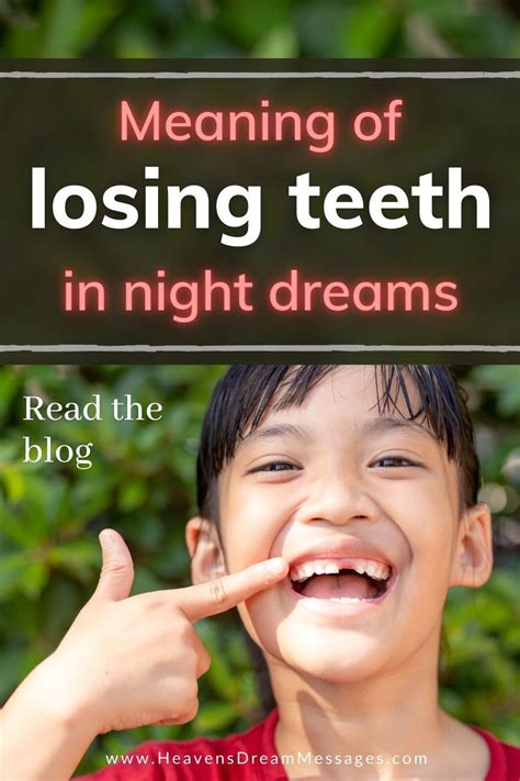 Symbolic Meanings Associated with Dreams of Unstable Teeth and Teeth Loss