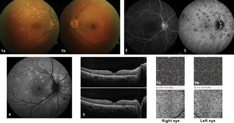 Symbolic Transformations Seen in Evanescent Visions