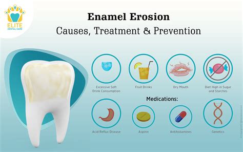 Symbolism and Interpretation: The Meaning Behind Deteriorating Enamel