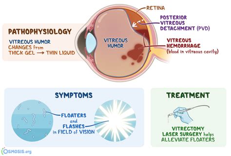 Symbolism of Fluid in Vision