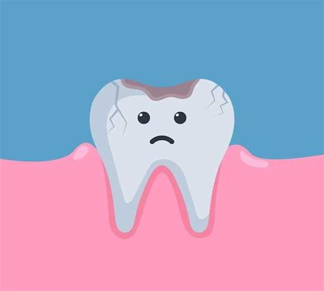 Symbolism of a Cracked Front Tooth in Dreams