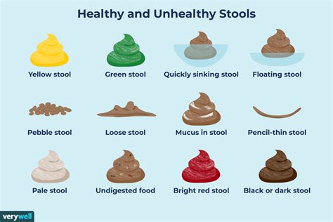 Symptoms Linked to a Yellow Stool: When to Seek Medical Assistance