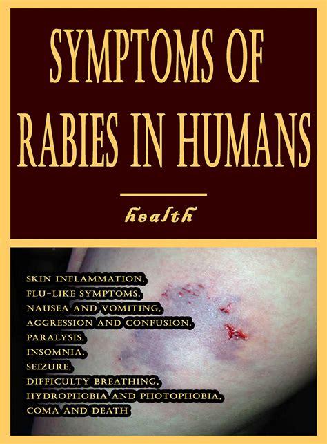 Symptoms Unleashed: Recognizing Rabies in Humans