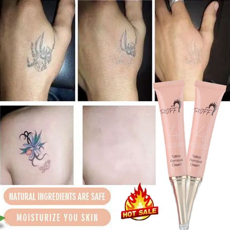 Tattoo Removal Creams: Do They Really Work?