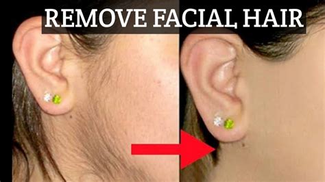 The Advantages of Threading for Facial Hair Removal