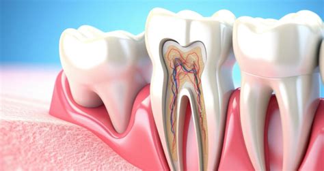 The Basics of Dental Infection