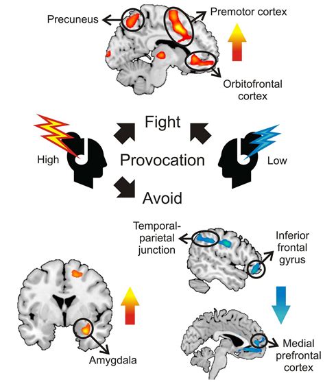 The Brain's Response to Threat: Exploring the Fight or Flight Reflex