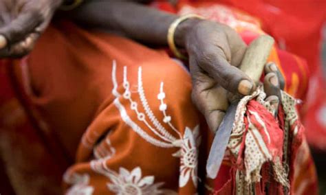 The Controversial Concept of Genital Cutting