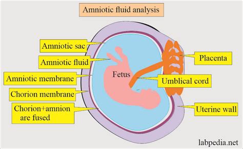 The Cultural and Historical Significance of Dreams Indicating the Rupture of Amniotic Fluid During the Maternal Gestation Period