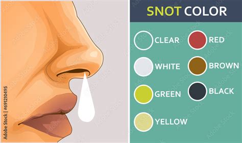 The Diverse Range of Nasal Discharge Colors