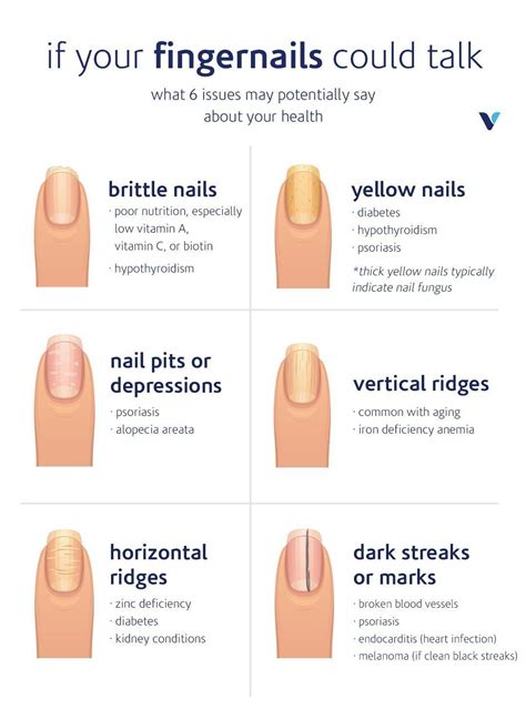 The Emotional Impact: Understanding the Psychological Effects of Dreams about Missing Fingernails