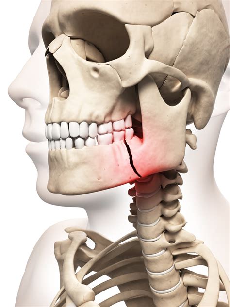 The Enigma of Facial Trauma in Reveries: Phenomenon, Significance, and Insight