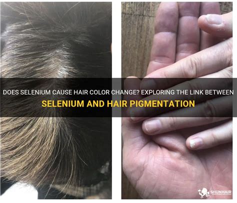 The Enigma of Hair Pigmentation Transformation Revealed