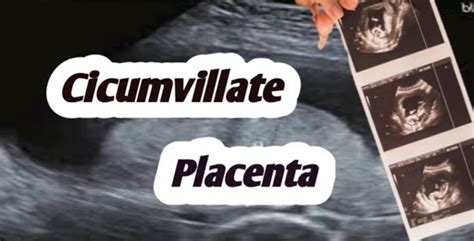 The Enigma of Placental Reveries