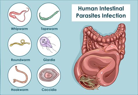 The Fascinating Phenomenon of Worms Emanating from the Abdomen