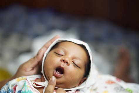 The Fascination of Infants Born with Teeth