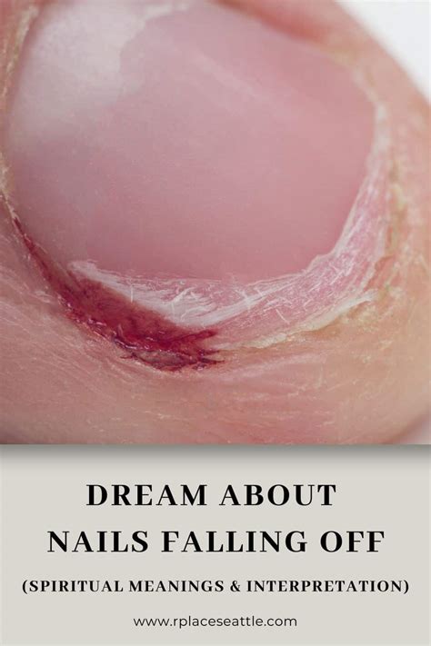 The Impact of Anxiety in Dreams about Detaching Manicured Nails