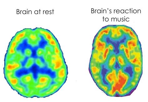 The Impact of Sounds: How Dreams from the Left Ear Mirror Inner Emotions