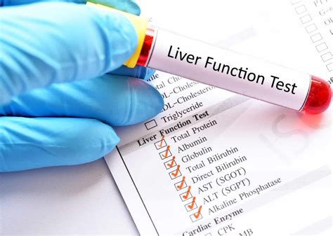 The Importance of Regular Liver Check-ups and Diagnostic Tests