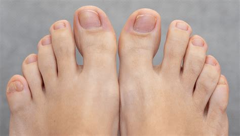 The Importance of the Little Toe in Dreams