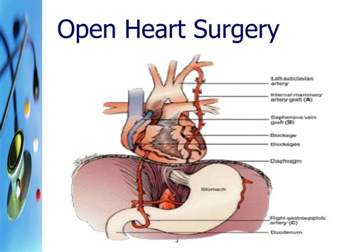 The Intrigue of Cardiac Surgical Procedures: What Sparks Interest in People's Minds?