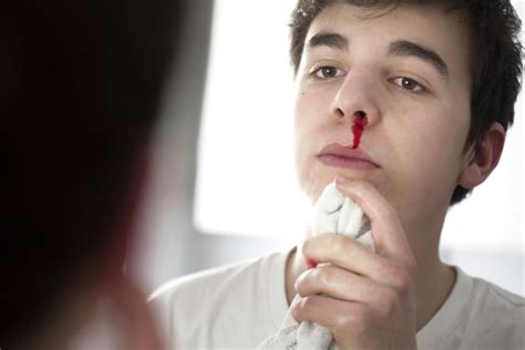 The Intriguing Phenomenon: Nightmares of Bloody Noses