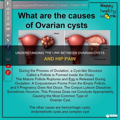 The Link Between Ovarian Cysts and Emotional Well-being: Deciphering Dream Meanings