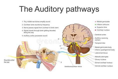 The Link Between Stress and Auditory Hemorrhage Nightmares