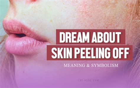 The Link Between Stress and Dreams of Skin Shedding: Insights from Experts