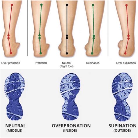 The Link between Foot Sole and Stability in Dreams