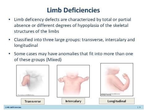 The Meaning Behind Children with Missing Limbs in Dream Analysis