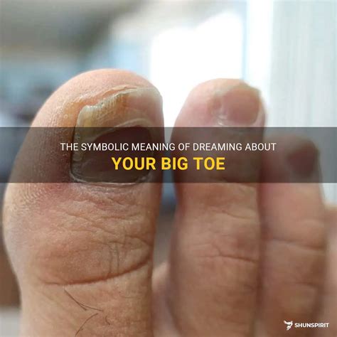 The Meaning of Dreaming about a Hurt Big Toe