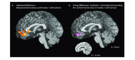 The Neurological Impact of Altruism: How Acts of Benevolence Influence the Brain