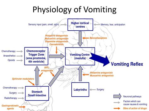 The Physical Factors Behind Experiencing Vomit Containing Stones